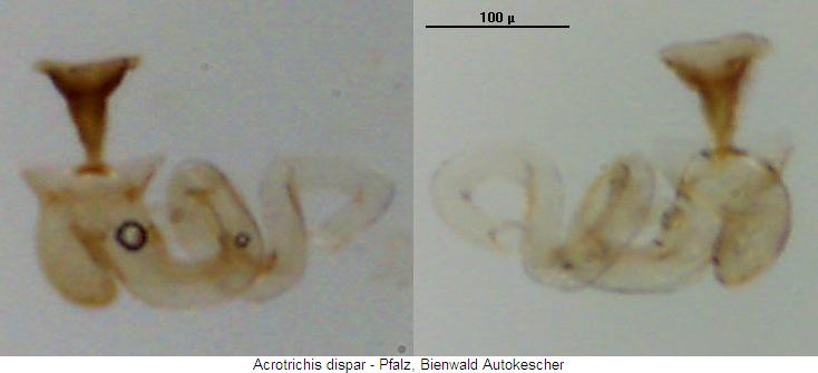 acrotrichis_dispar_sperm.jpg