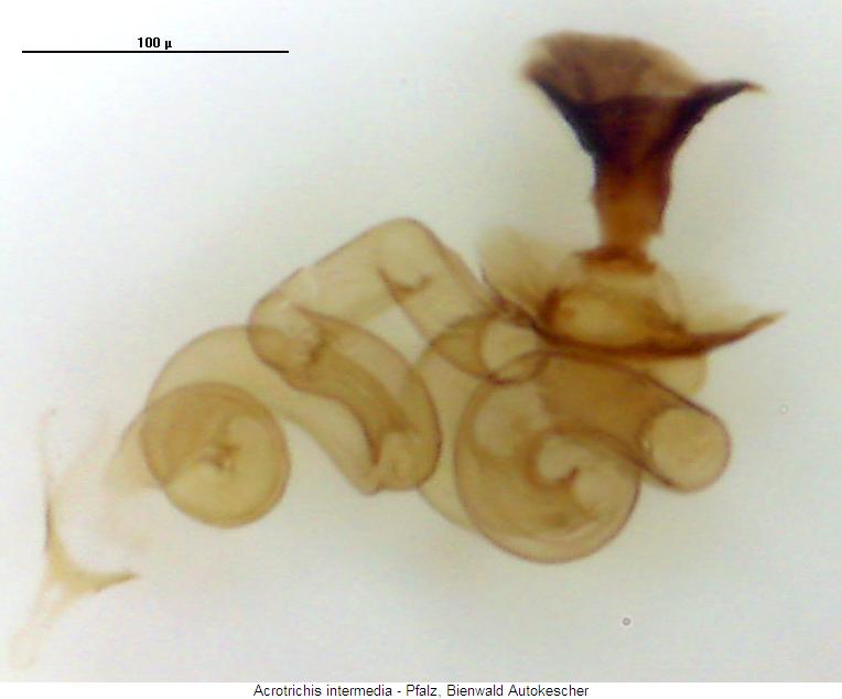 acrotrichis_intermedia_sperm2.jpg