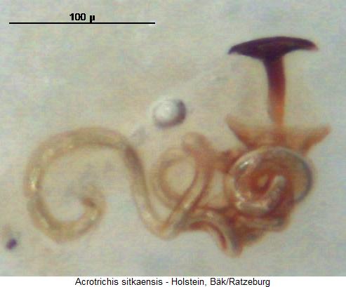 acrotrichis_sitkaensis_sperm1.jpg
