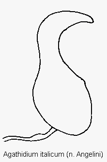 agathidium_italicum_sperm.gif