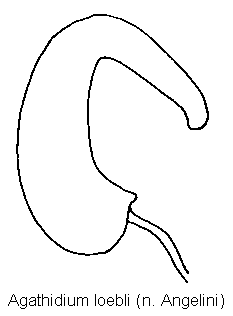 agathidium_loebli_sperm.gif