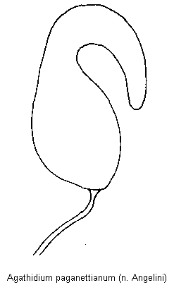 agathidium_paganettianum_sperm.gif