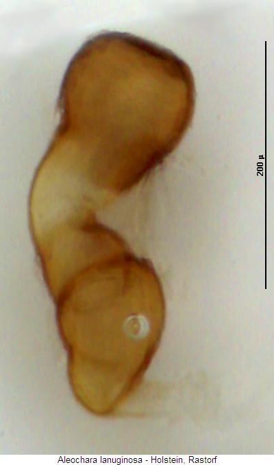 aleochara_lanuginosa_sperm.jpg