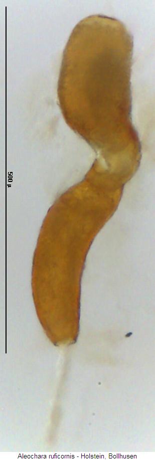 aleochara_ruficornis_sperm.jpg