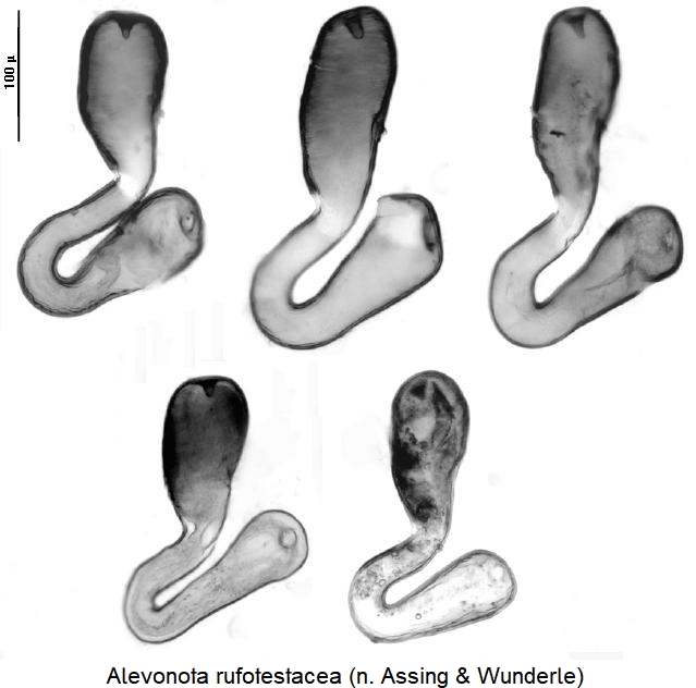 alevonota_rufotestacea_sperm.jpg