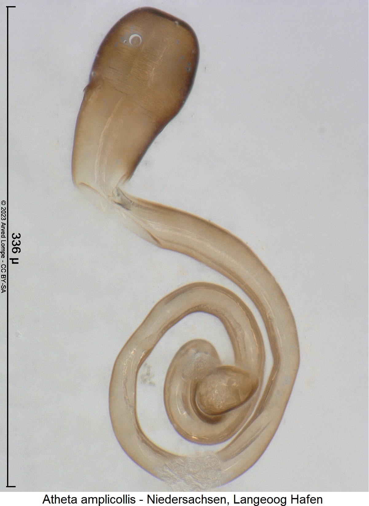 atheta_amplicollis_sperm1.jpg