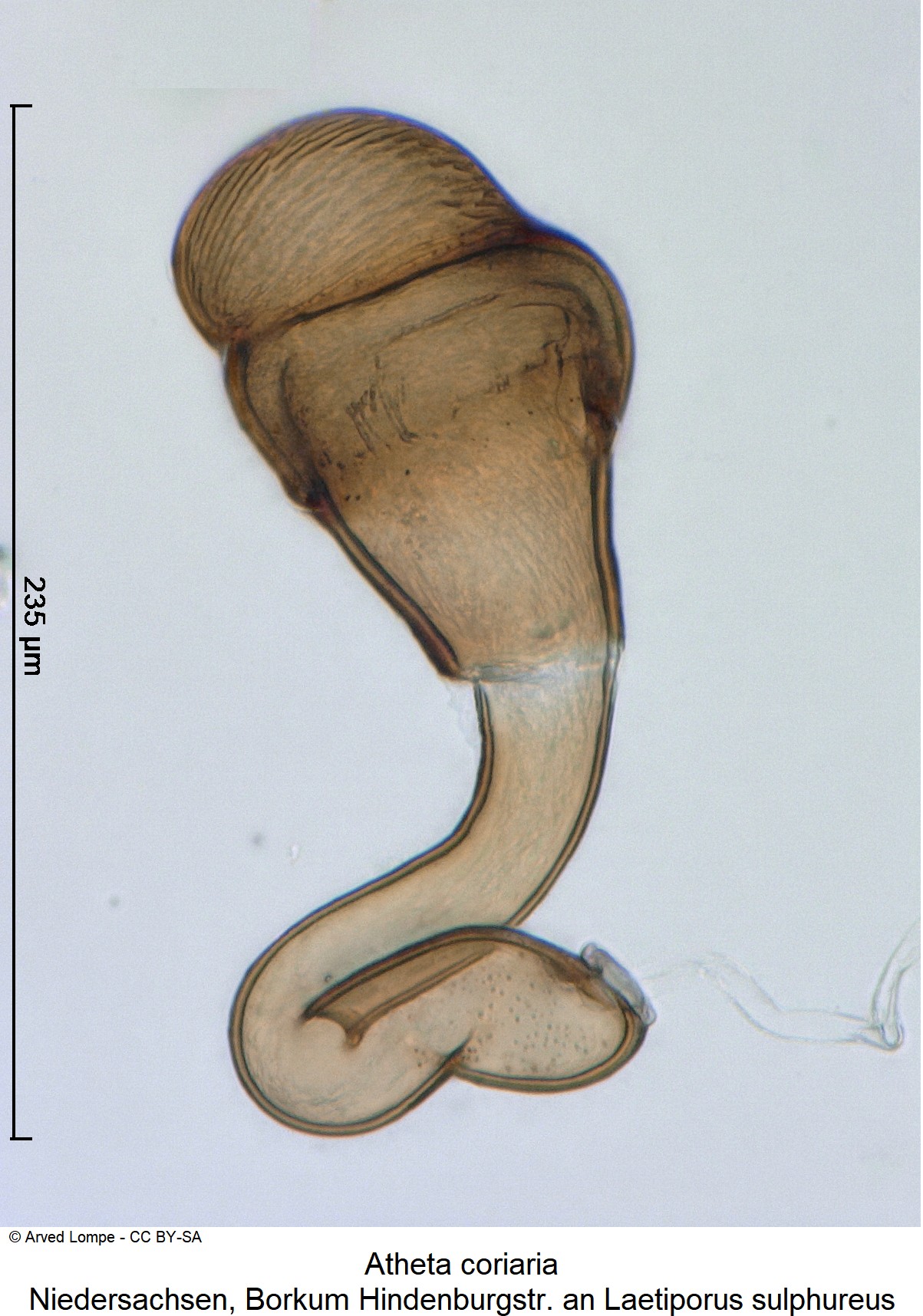 atheta_coriaria_ck33142638_sperm.jpg