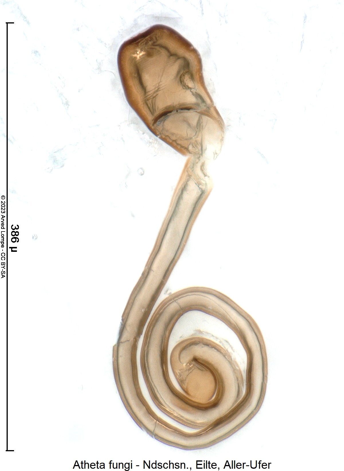 atheta_fungi_sperm4.jpg