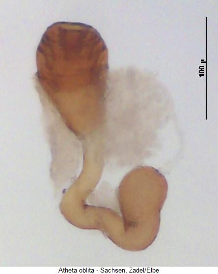 atheta_oblita_sperm.jpg