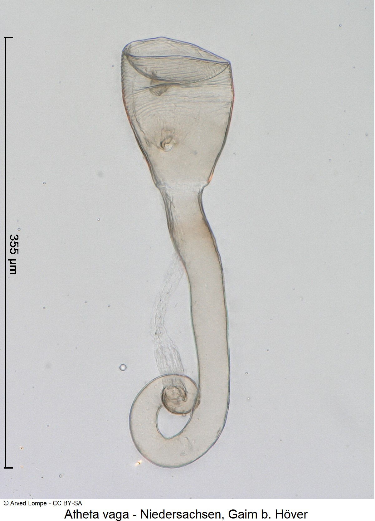 atheta_vaga_ck38056095_sperm.jpg