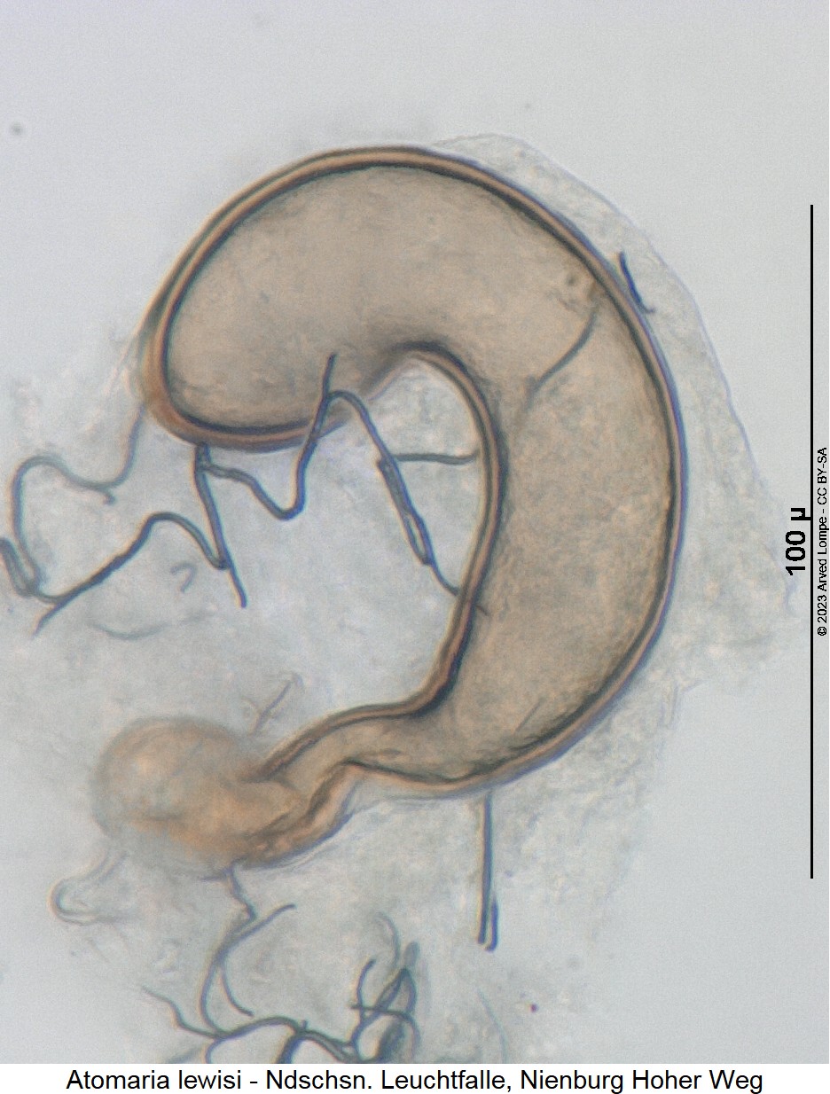 atomaria_lewisi_sperm.jpg