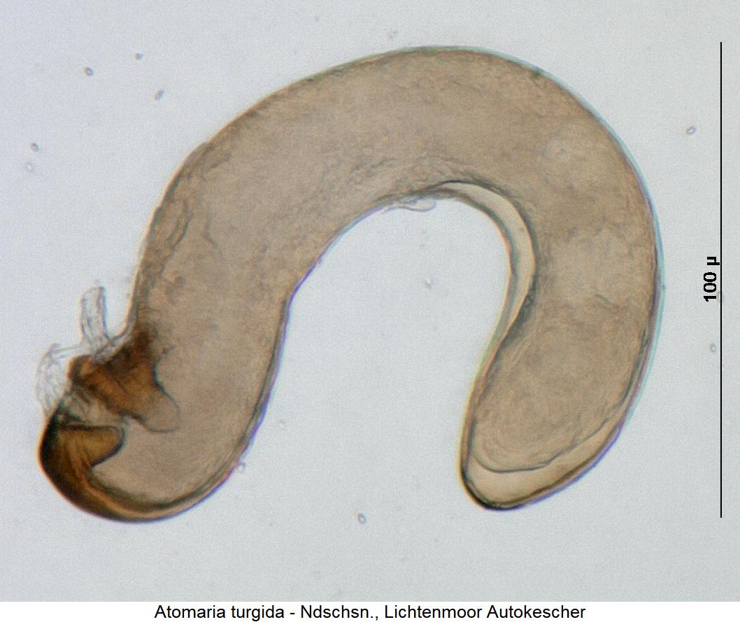 atomaria_turgida_sperm.jpg