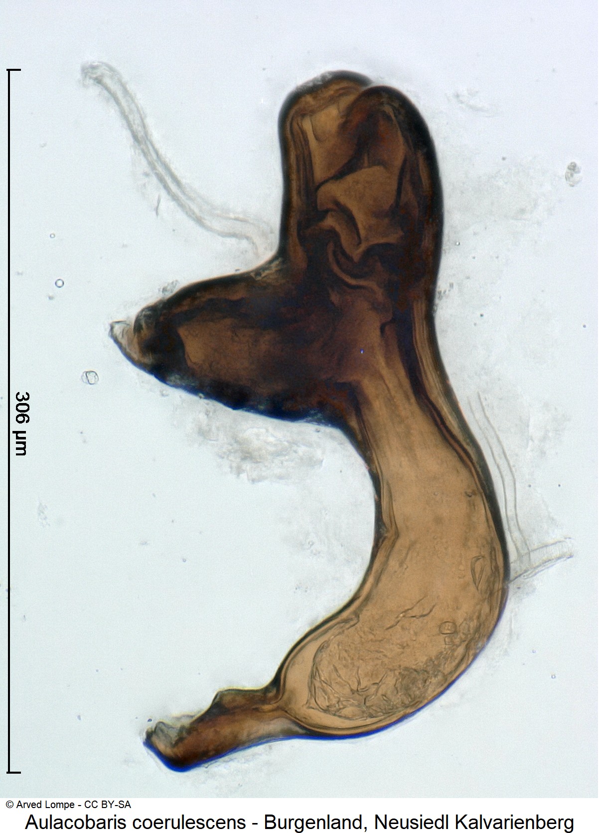 aulacobaris_coerulescens_ck14867_sperm.jpg