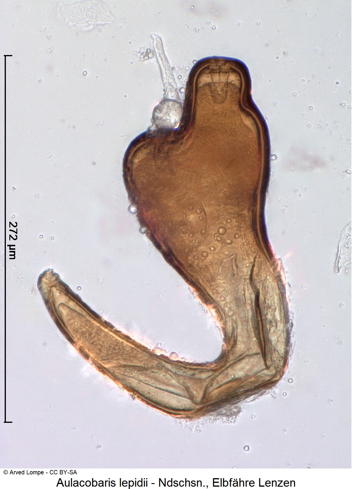 aulacobaris_lepidii_ck14866_sperm.jpg