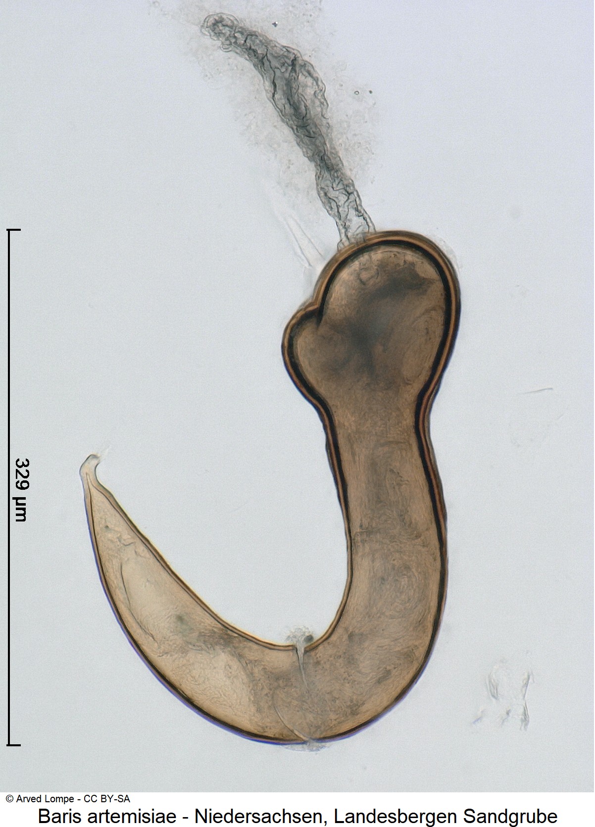 baris_artemisiae_ck31935905_sperm.jpg