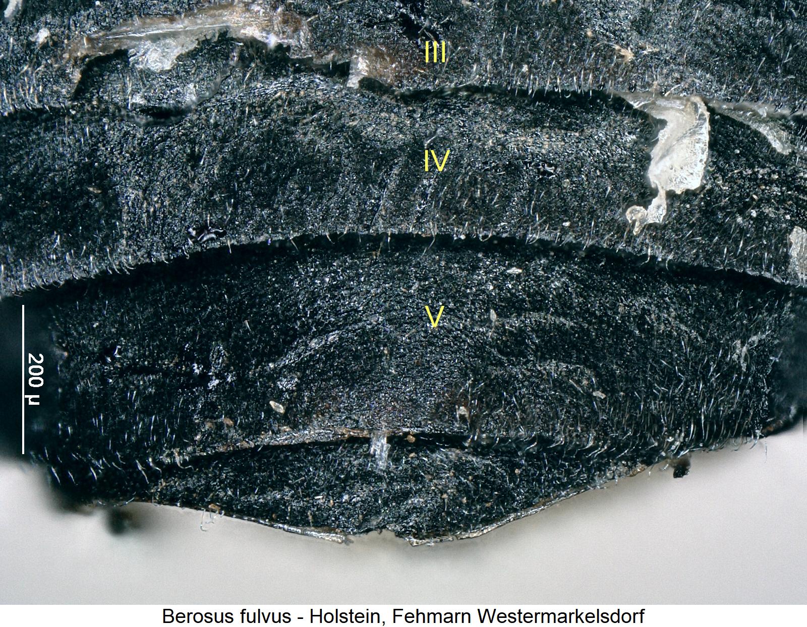 berosus_fulvus_abd.jpg