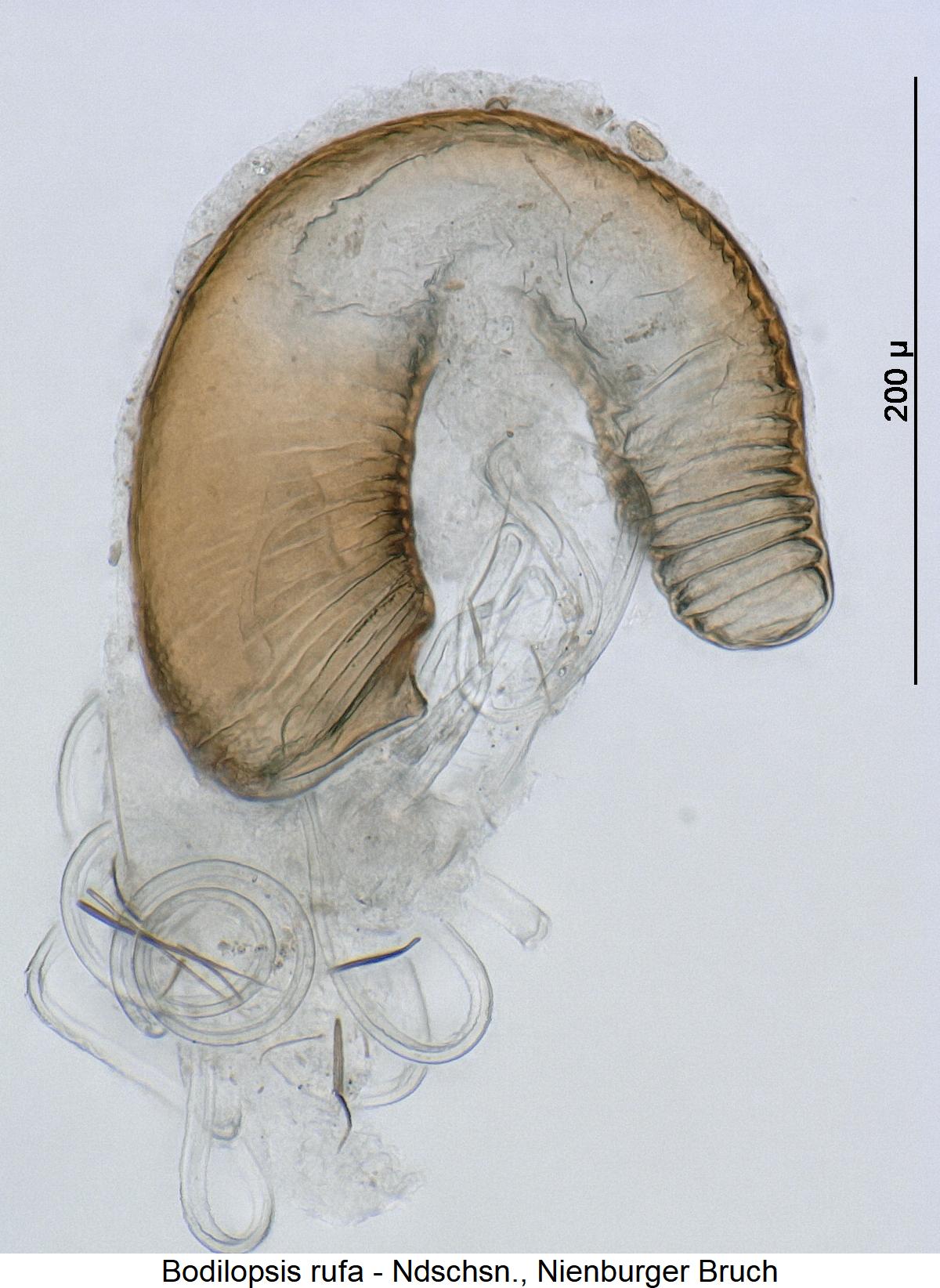 bodilopsis_rufa_sperm.jpg