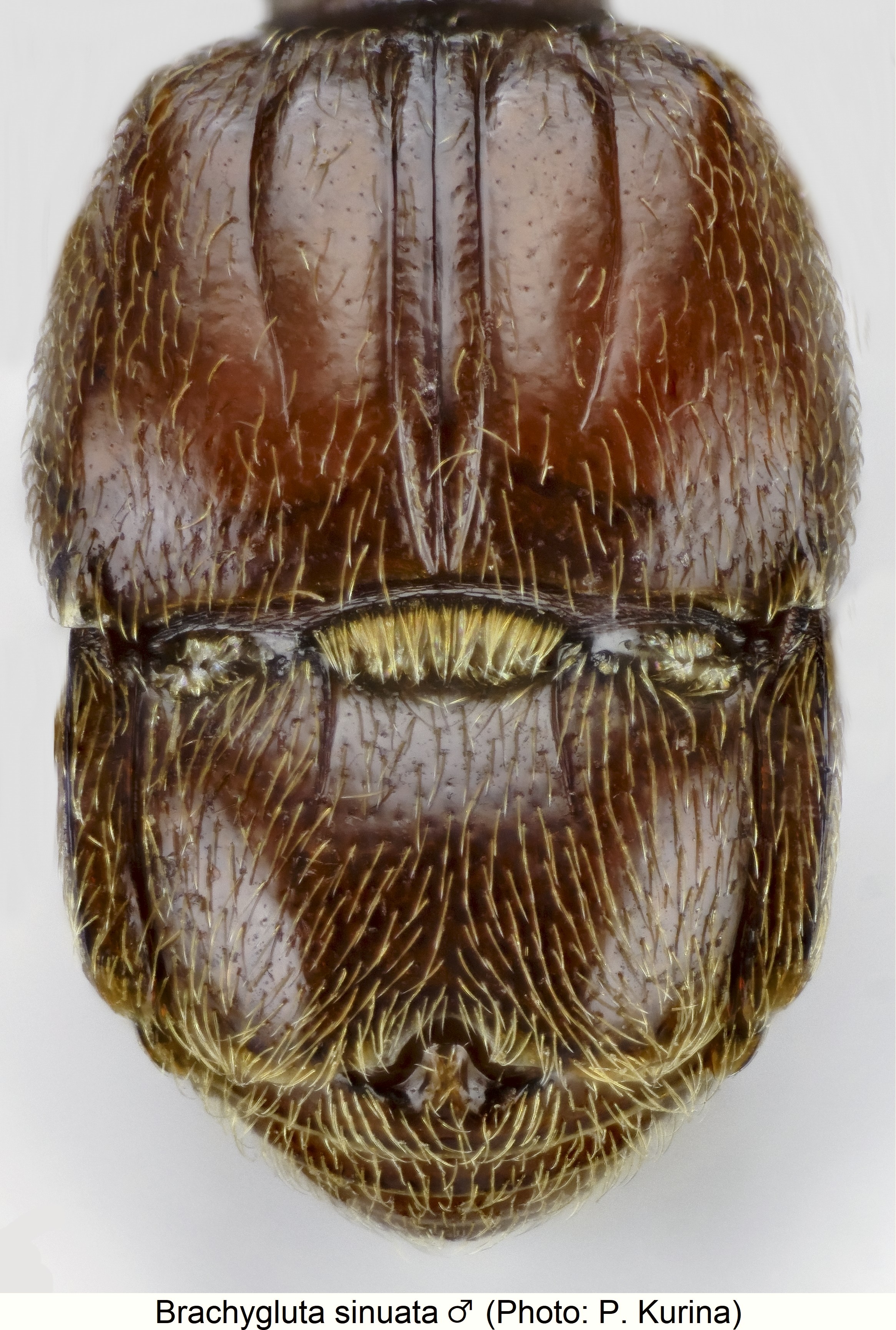 brachygluta_sinuata_m_abd.jpg