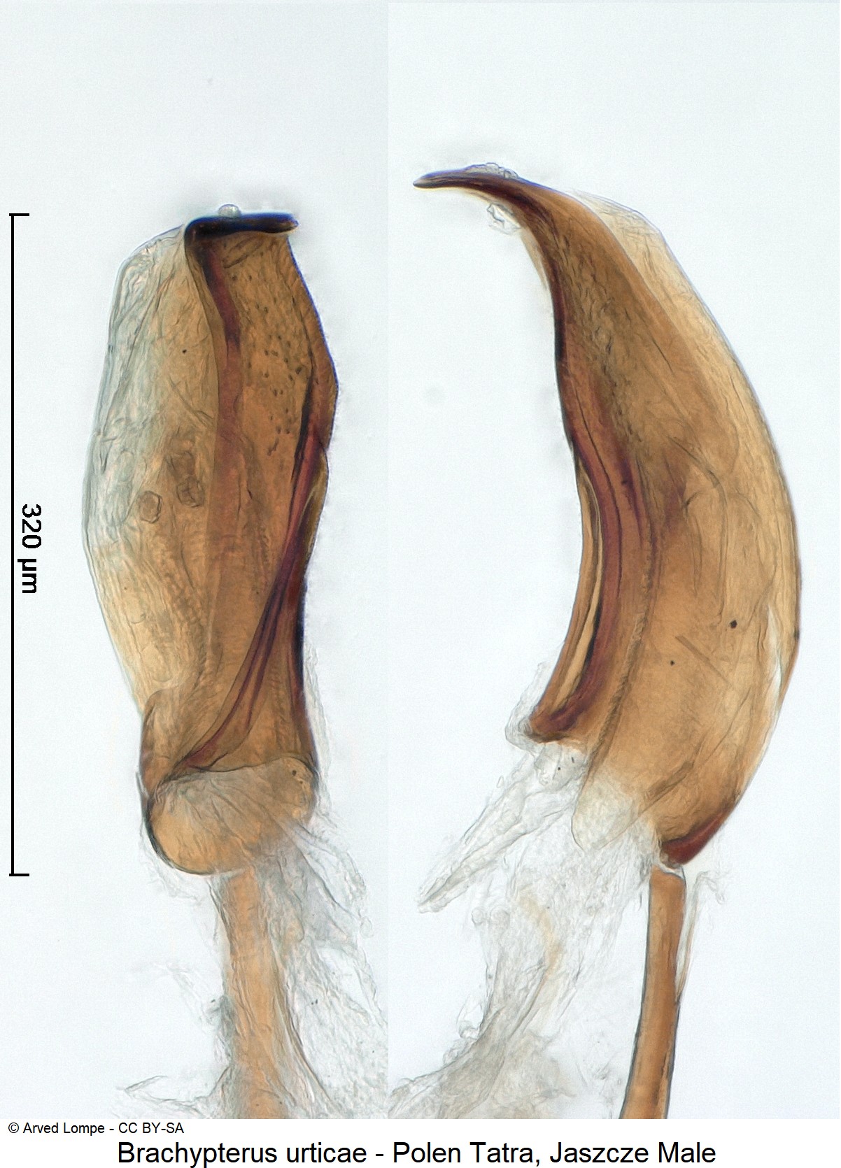 brachypterus_urticae_ck33258063_pen.jpg