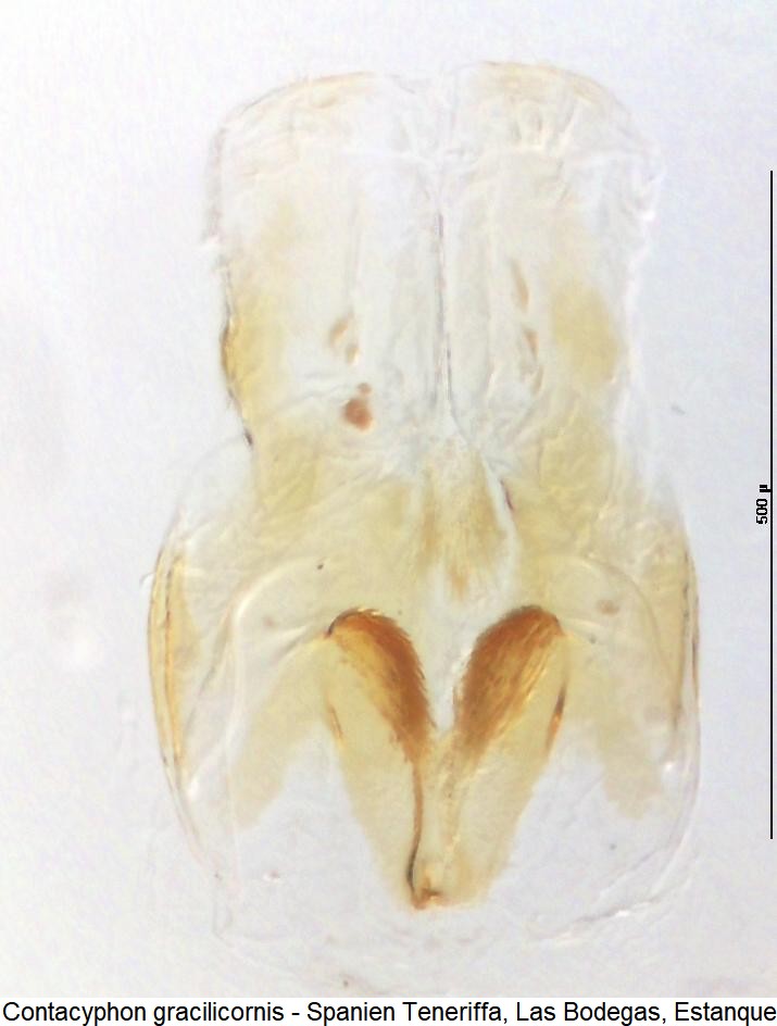 contacyphon_gracilicornis_bur.jpg