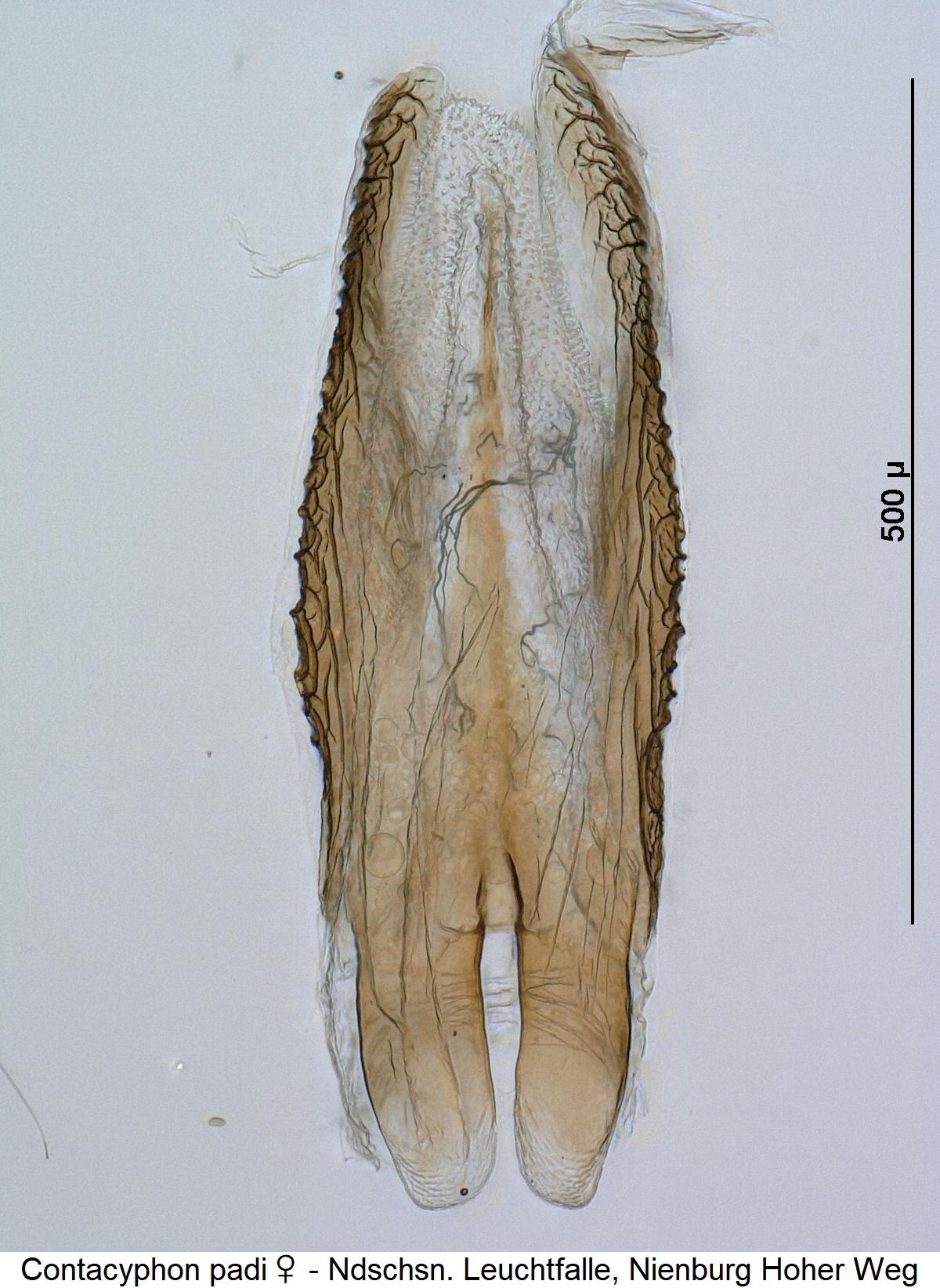 contacyphon_padi_w_bur.jpg