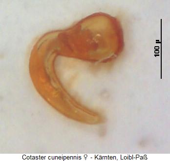 cotaster_cuneipennis_sperm.jpg