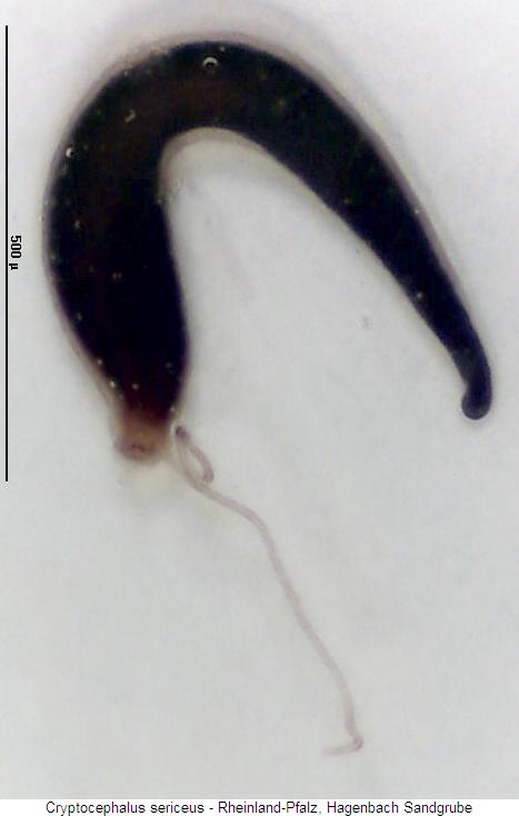 cryptocephalus_sericeus_sperm.jpg