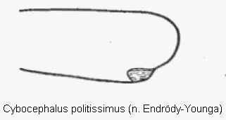 cybocephalus_politissimus_vschn.gif