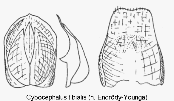 cybocephalus_tibialis.gif