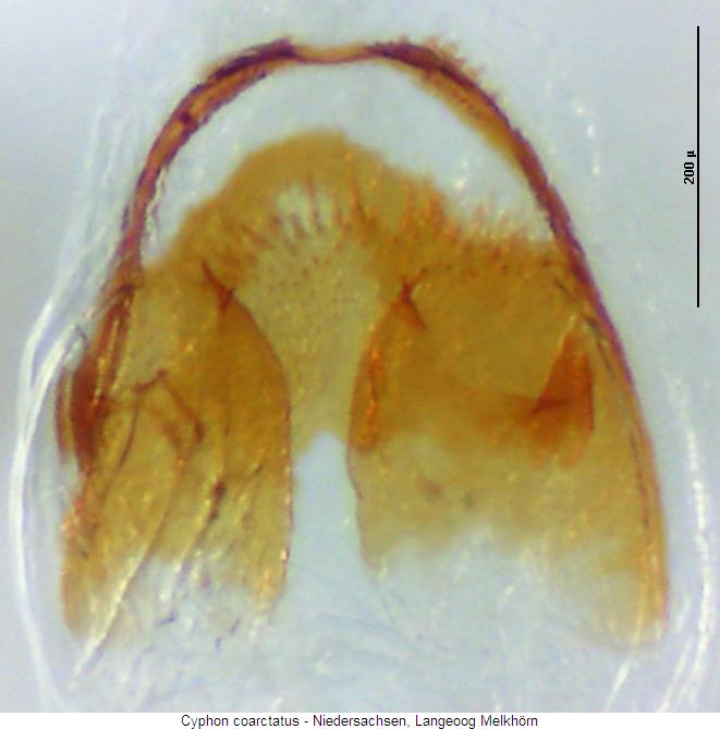 cyphon_coarctatus_sperm.jpg