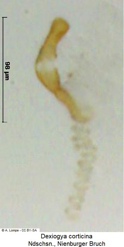 dexiogya_corticina_sperm.jpg