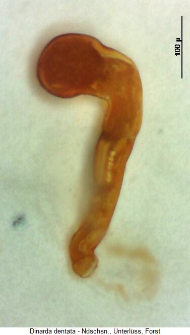 dinarda_dentata_sperm.jpg