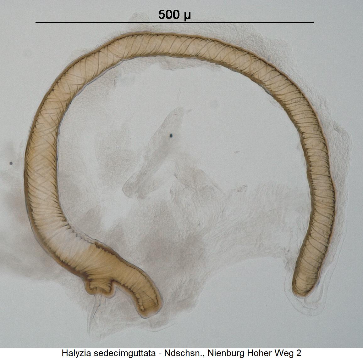 halyzia_sedecimguttata_sperm.jpg