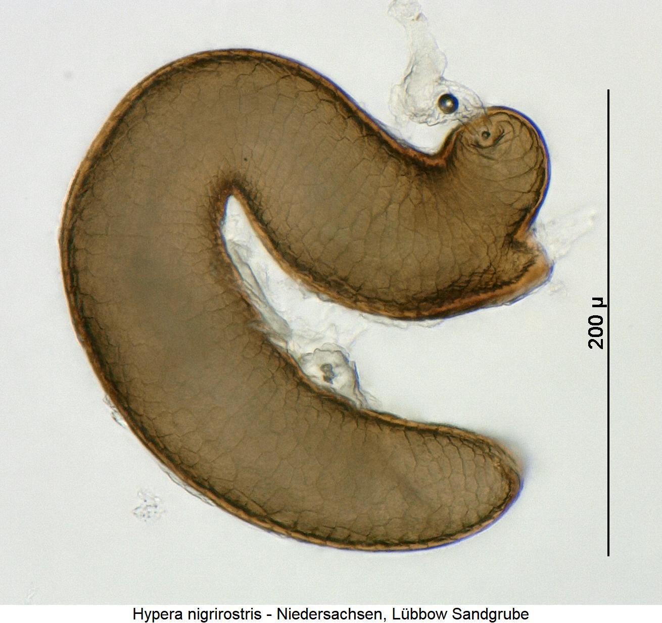 hypera_nigrirostris_sperm.jpg