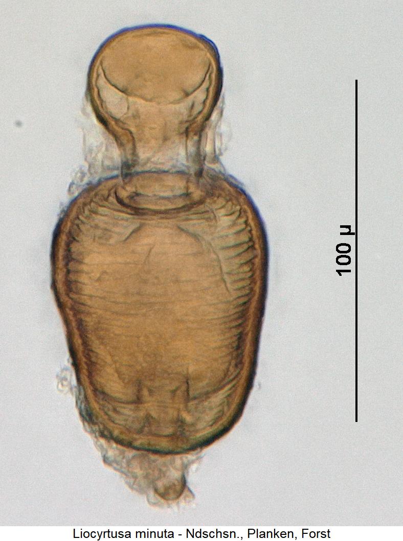 liocyrtusa_minuta_sperm.jpg