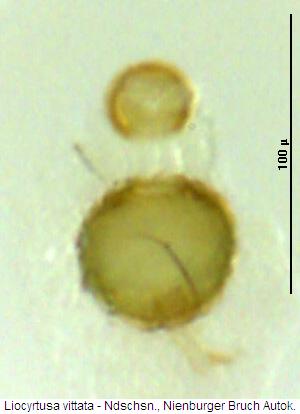 liocyrtusa_vittata_sperm.jpg