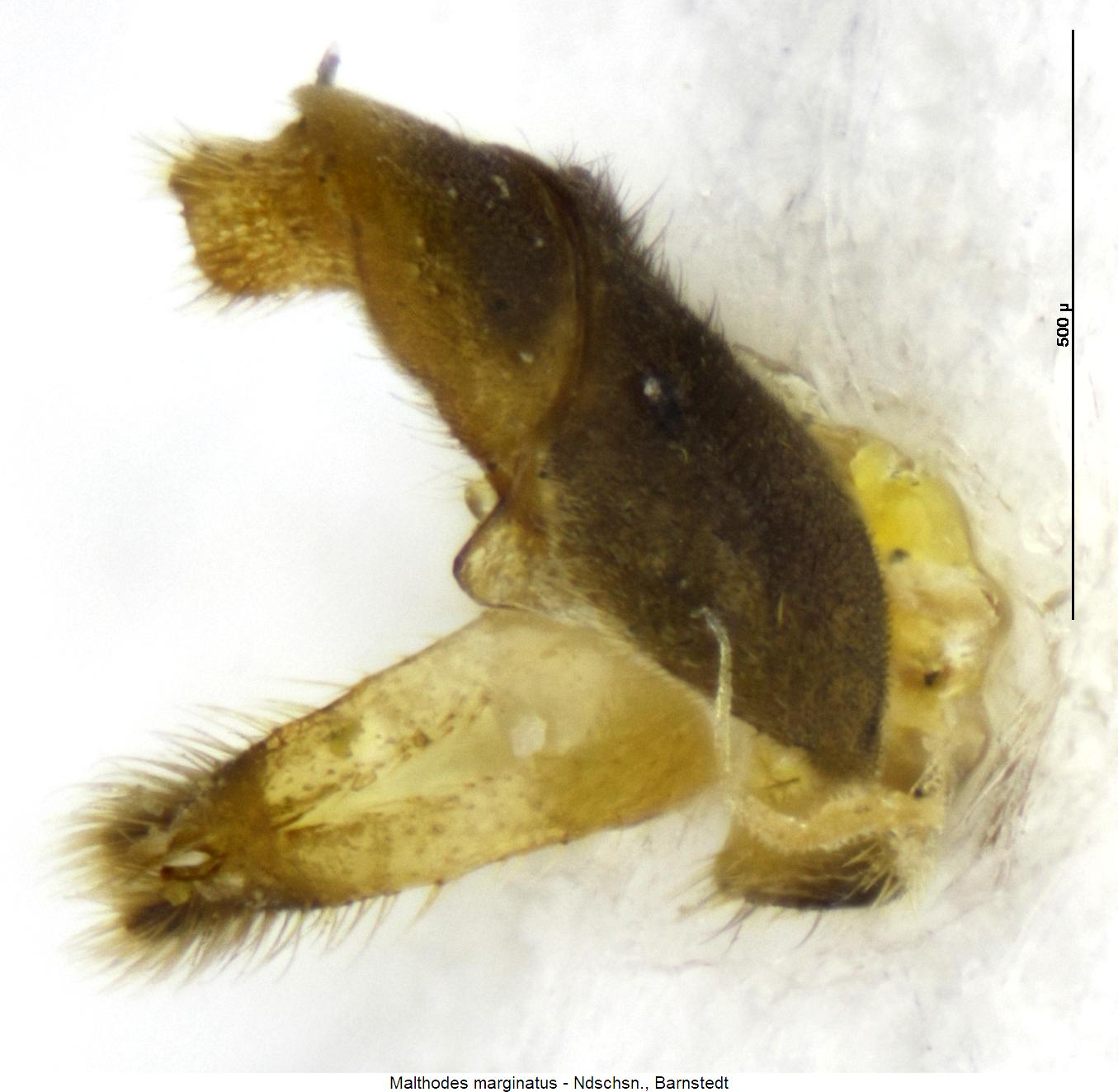 malthodes_marginatus_abd1.jpg
