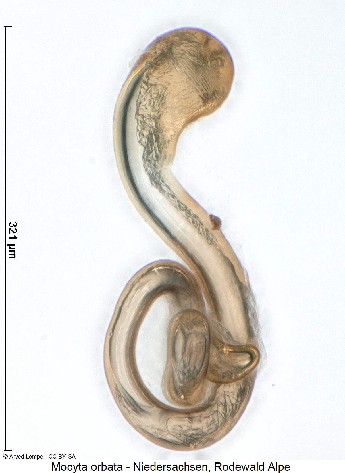 mocyta_orbata_ck29873820_sperm.jpg