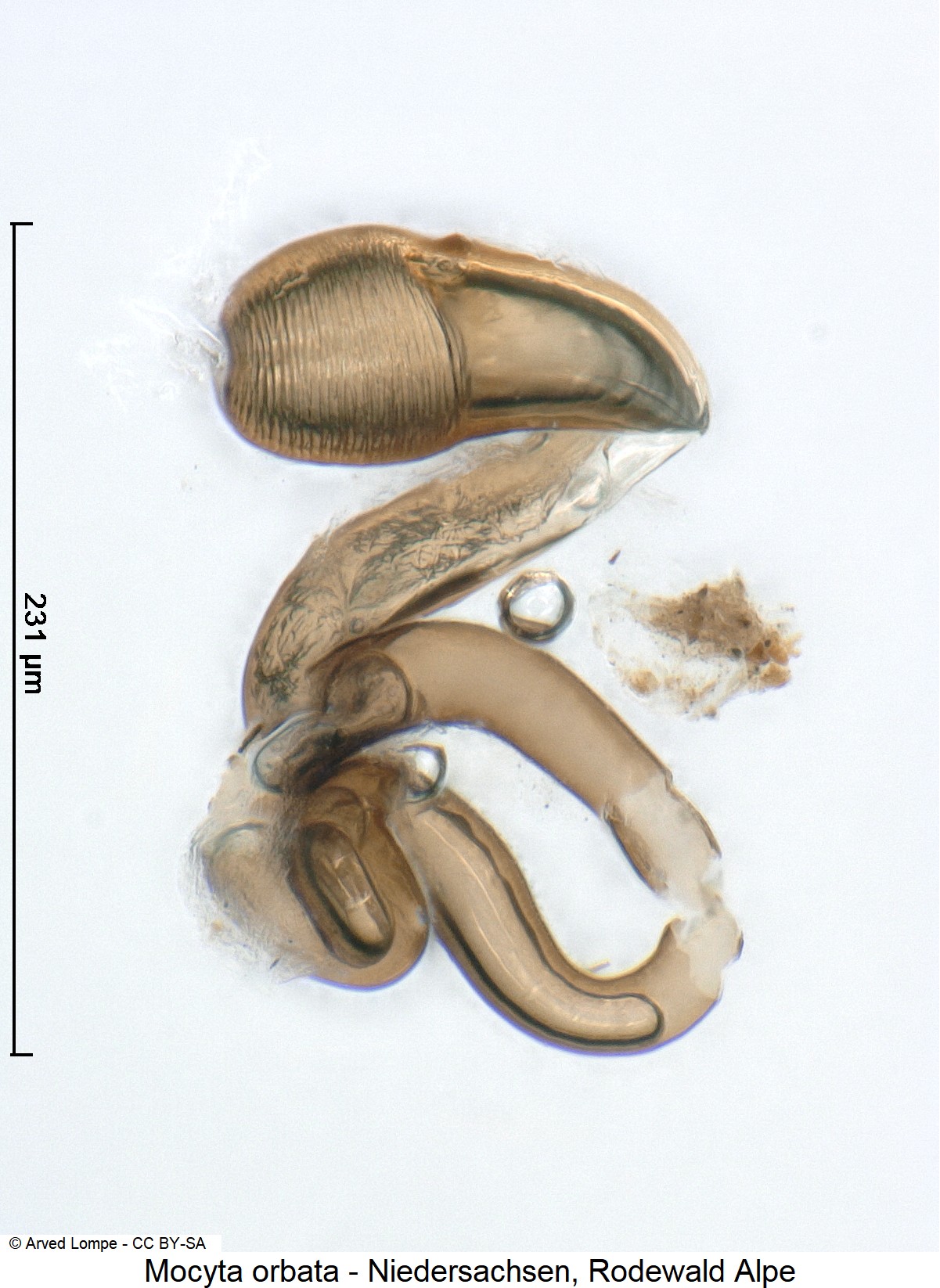 mocyta_orbata_ck29878566_sperm.jpg