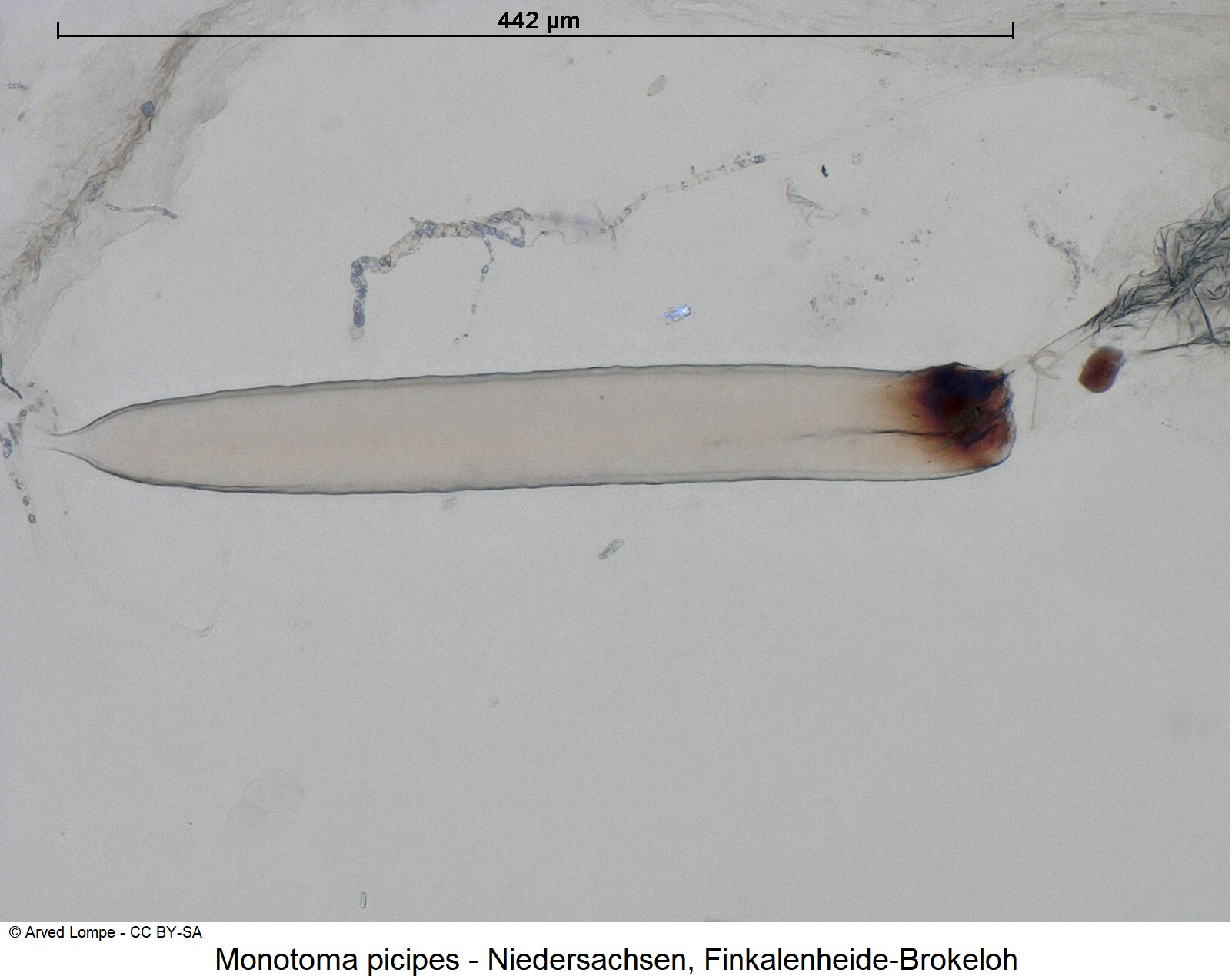 monotoma_picipes_ck36056552_sperm.jpg
