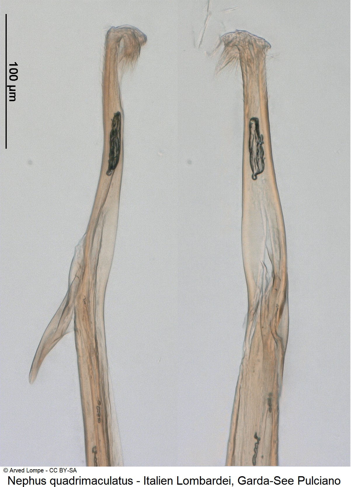 nephus_quadrimaculatus_ck37285927_sipho.jpg