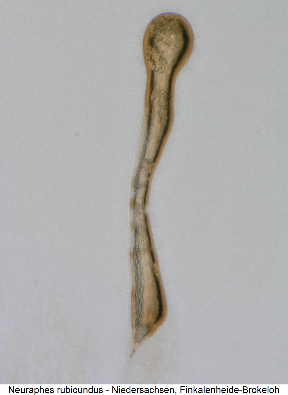 neuraphes_rubicundus_sperm.jpg
