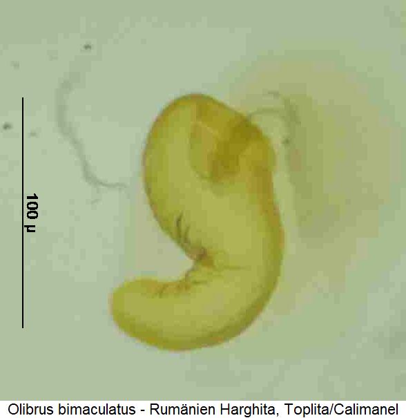 olibrus_bimaculatus_sperm.jpg
