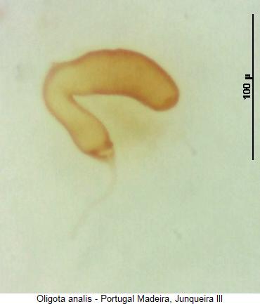 oligota_analis_sperm.jpg