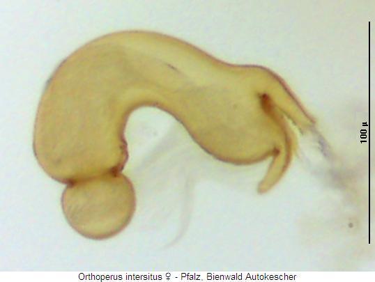 orthoperus_intersitus_sperm.jpg