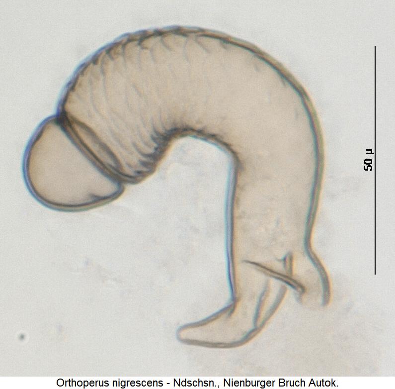 orthoperus_nigrescens_sperm1.jpg