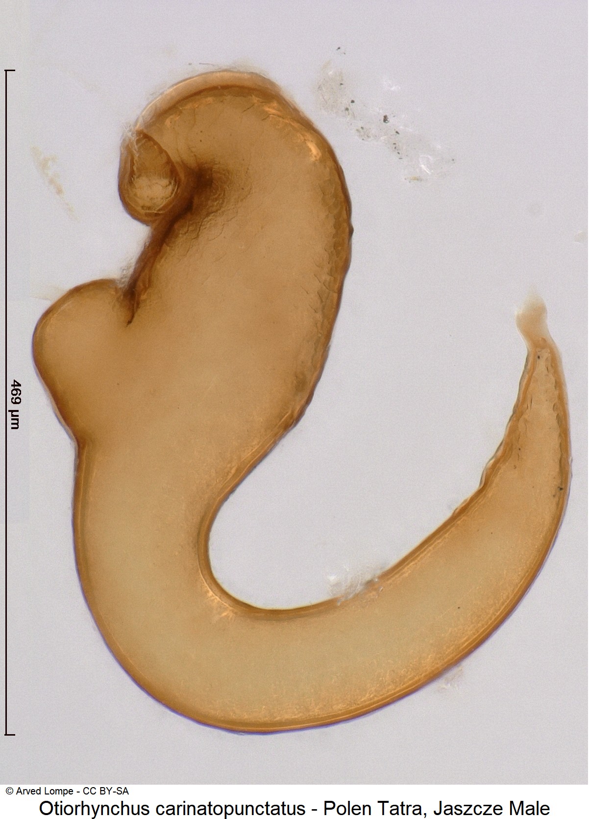 otiorhynchus_carinatopunctatus_ck33164416_sperm.jpg