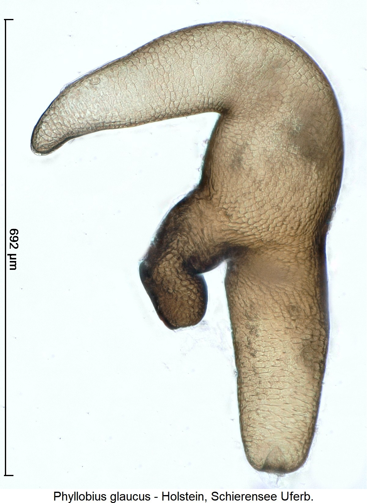 phyllobius_glaucus_ck13800_sperm.jpg