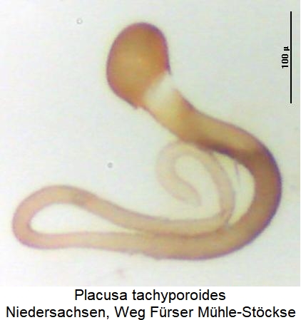 placusa_tachyporoides_sperm.jpg