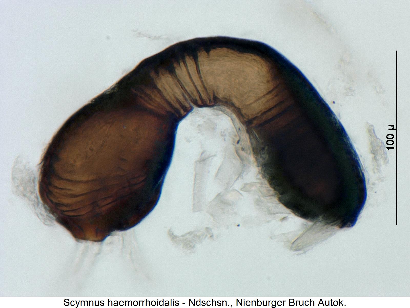 scymnus_haemorrhoidalis_sperm.jpg